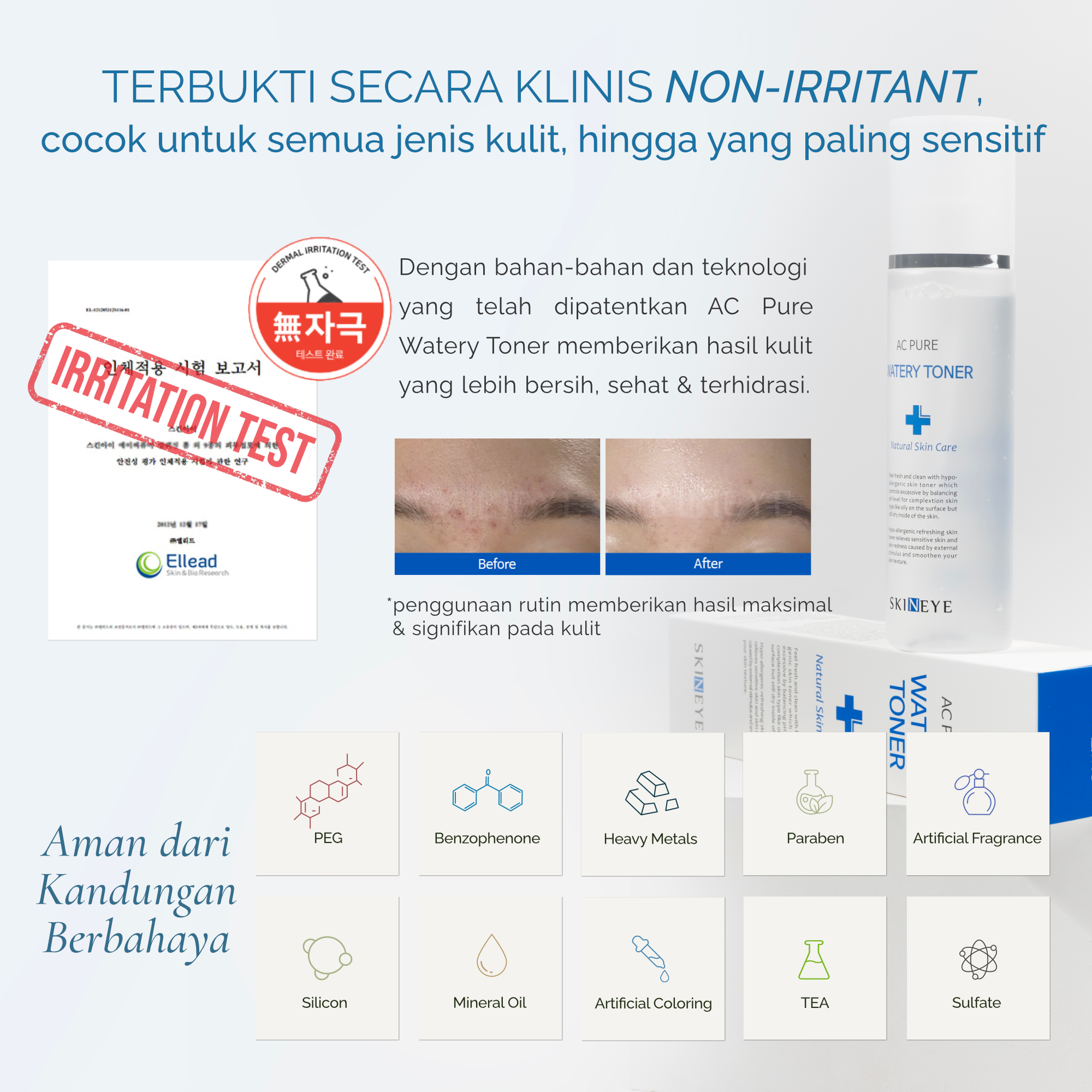 AC PURE WATERY TONER 150ML - Image 7